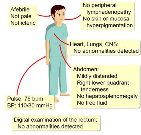 burkitt lymphoma clinical features.